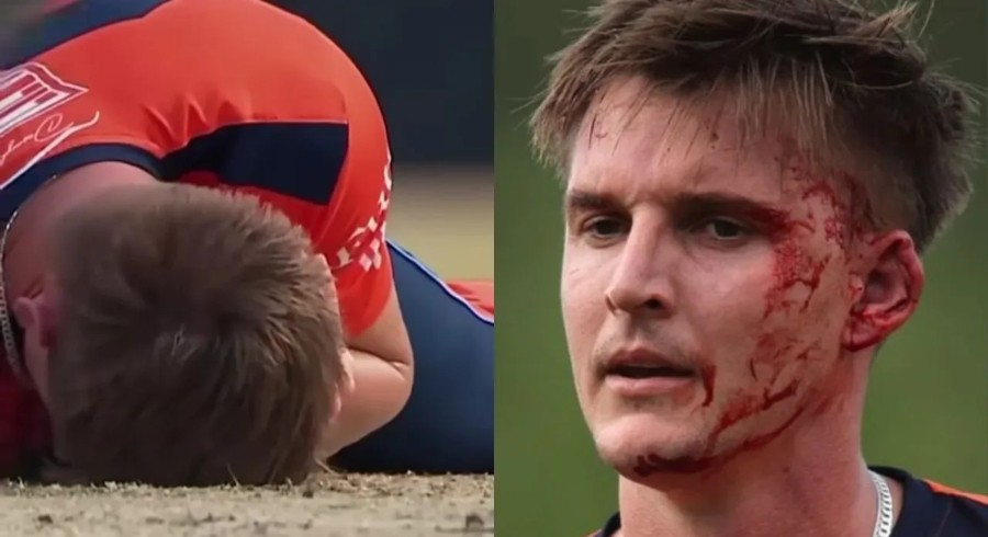 WATCH: South African bowler badly injured by batter’s powerful hit in MLC