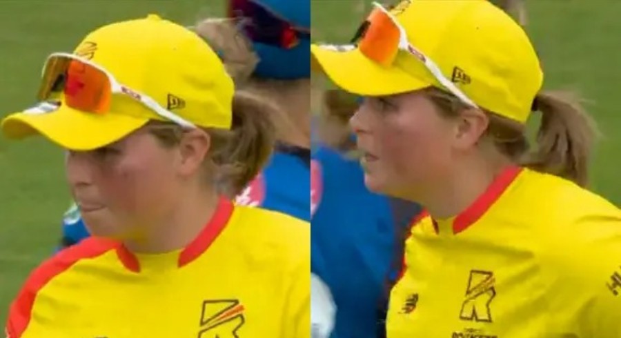 Grace Scrivens suffers black eye in the Hundred Women's 2024 match after ball hits face